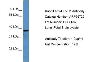 WB Suggested Anti-OR2H1  Antibody Titration: 0. (OR2H1 抗体  (C-Term))