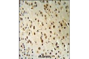 TARSL2 Antibody (C-term) (R) IHC analysis in formalin fixed and paraffin embedded human brain tissue followed by peroxidase conjugation of the secondary antibody and DAB staining. (TARSL2 抗体  (C-Term))