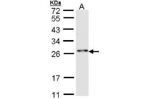 WB Image Sample (30 ug of whole cell lysate) A:Hep G2 , 12 % SDS PAGE antibody diluted at 1:1000 (RNF114 抗体)