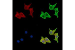 anti-CDK5 Regulatory Subunit Associated Protein 2 (CDK5RAP2) antibody