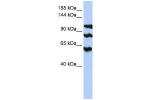 PPP1R13B antibody used at 1 ug/ml to detect target protein. (PPP1R13B 抗体)