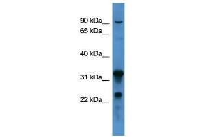 Western Blot showing F8 antibody used at a concentration of 1-2 ug/ml to detect its target protein.
