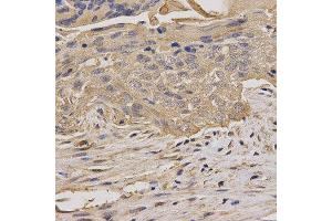 Immunohistochemistry (IHC) image for anti-Myelin Oligodendrocyte Glycoprotein (MOG) antibody (ABIN1876541) (MOG 抗体)