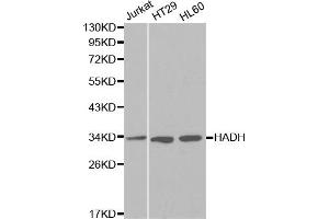 Western blot analysis of extracts of various cell lines, using HADH antibody (ABIN5970434) at 1/1000 dilution. (HADH 抗体)