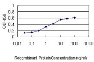 Detection limit for recombinant GST tagged PIM1 is approximately 0. (PIM1 抗体  (AA 1-100))