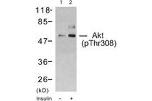 Western blot analysis of extracts from 293 cells treated with Insulin, using Akt (Phospho-Thr308) Antibody. (AKT1 抗体  (pThr308))