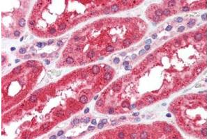 Human Kidney (formalin-fixed, paraffin-embedded) stained with FGFR4 antibody ABIN462303 followed by biotinylated anti-mouse IgG secondary antibody ABIN481714, alkaline phosphatase-streptavidin and chromogen. (FGFR4 抗体)