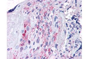 Anti-ADAMTS5 antibody IHC of human placenta. (ADAMTS5 抗体  (N-Term))