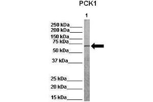 WB Suggested Anti-PCK1 Antibody    Positive Control:  Lane 1: 80ug pig serum   Primary Antibody Dilution :   1:1000  Secondary Antibody :  Anti-rabbit-HRP   Secondry Antibody Dilution :   1:1000  Submitted by:  Martina Ondrovics, University of Veterinary Medicine Vienna