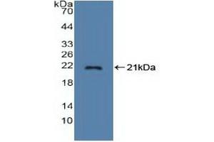 Detection of Recombinant STMN1, Human using Polyclonal Antibody to Stathmin 1 (STMN1) (Stathmin 1 抗体  (AA 2-149))