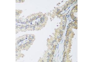 Immunohistochemistry of paraffin-embedded human prostate using IGFBP4 antibody at dilution of 1:100 (40x lens). (IGFBP4 抗体)