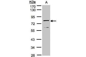 WB Image Sample(30 μg of whole cell lysate) A:MOLT4, 10% SDS PAGE antibody diluted at 1:1000 (DPP3 抗体)