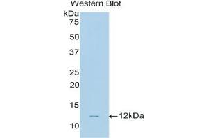 Detection of Recombinant CNP, Human using Polyclonal Antibody to C-Type Natriuretic Peptide (CNP) (NPPC 抗体  (AA 33-125))