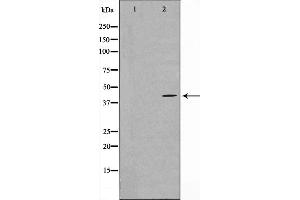 Western blot analysis on COLO205 cell lysate using MAPK3 Antibody,The lane on the left is treated with the antigen-specific peptide. (MAPKAP Kinase 3 抗体  (C-Term))