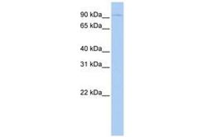 Image no. 1 for anti-Thyroid Stimulating Hormone Receptor (TSHR) (AA 180-229) antibody (ABIN6743075) (TSH receptor 抗体  (AA 180-229))