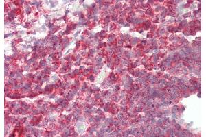Immunohistochemistry (IHC) image for anti-Profilin 1 (PFN1) (N-Term) antibody (ABIN2783306)