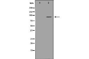 Western blot analysis of extracts of Jurkat, using FGFR1 antibody. (FGFR1 抗体  (C-Term))