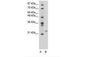 Image no. 2 for anti-Polyamine Modulated Factor 1 (PMF1) (AA 59-108) antibody (ABIN6736312) (PMF1 抗体  (AA 59-108))