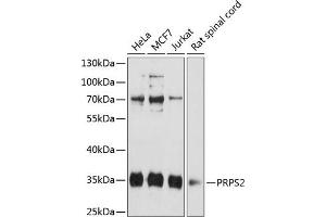 Western blot analysis of extracts of various cell lines, using PRPS2 antibody (ABIN6132522, ABIN6146273, ABIN6146275 and ABIN6216353) at 1:3000 dilution. (PRPS2 抗体  (AA 1-240))