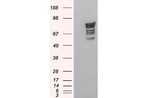 Western Blotting (WB) image for anti-phosphodiesterase 4D, cAMP-Specific (PDE4D) antibody (ABIN5930195) (PDE4D 抗体)