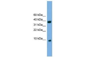 RPS21 antibody used at 1 ug/ml to detect target protein. (RPS21 抗体  (Middle Region))