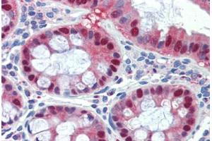 Human Colon (formalin-fixed, paraffin-embedded) stained with SCML1 antibody ABIN462201 followed by biotinylated goat anti-rabbit IgG secondary antibody ABIN481713, alkaline phosphatase-streptavidin and chromogen. (SCML1 抗体  (AA 108-157))
