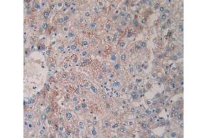 DAB staining on IHC-P; Samples: Human Liver Tissue (TPSAB1 抗体  (AA 161-262))