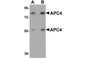 Western blot analysis of APC4 in mouse liver tissue lysate with APC4 antibody at (A) 1 and (B) 2 μg/ml. (ANAPC4 抗体  (N-Term))