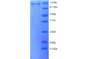 SDS-PAGE (SDS) image for Catenin (Cadherin-Associated Protein), beta 1, 88kDa (CTNNB1) (AA 2-781), (partial) protein (GST tag) (ABIN7479156)