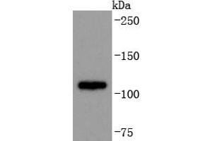 Jurkat cell lysate probed with ADAM17 (9E7) Monoclonal Antibody, Unconjugated  at 1:1000 overnight at 4˚C.