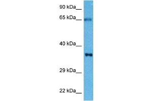 Host:  Mouse  Target Name:  TNNT2  Sample Tissue:  Mouse Skeletal Muscle  Antibody Dilution:  1ug/ml (Cardiac Troponin T2 抗体  (N-Term))