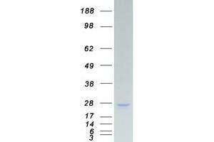 Western Blotting (WB) image for Synovial Sarcoma, X Breakpoint 2 (SSX2) (Transcript Variant 1) protein (Myc-DYKDDDDK Tag) (ABIN2732726)