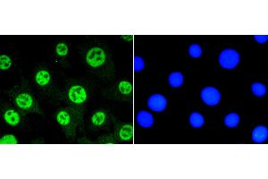 Immunofluorescence (Cultured Cells) (IF (cc)) image for anti-Signal Transducer and Activator of Transcription 3 (Acute-Phase Response Factor) (STAT3) (pSer727) antibody (ABIN5557530)