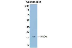 Western blot analysis of the recombinant protein. (LEFTY2 抗体  (AA 245-356))