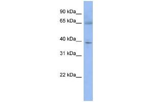 WB Suggested Anti-ZNF302 Antibody Titration:  0. (ZNF302 抗体  (N-Term))