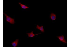 ABIN6259942 and ABIN6277949 staining HepG2 by IF/ICC.
