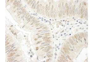 Immunohistochemistry (IHC) image for anti-Nucleolar and Coiled-Body Phosphoprotein 1 (NOLC1) (AA 1-50) antibody (ABIN7448695)