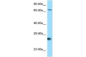 WB Suggested Anti-BAG1 Antibody Titration: 1. (BAG1 抗体  (N-Term))