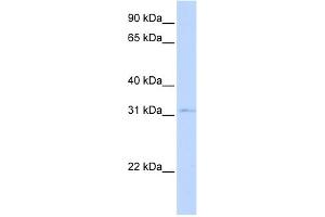 WB Suggested Anti-NKX3-1 Antibody Titration:  0. (NKX3-1 抗体  (Middle Region))
