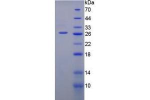 SDS-PAGE analysis of Mouse GPI Protein. (GPI 蛋白)