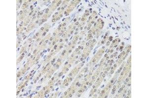Immunohistochemistry of paraffin-embedded Mouse stomach using FANCL Polyclonal Antibody at dilution of 1:100 (40x lens). (FANCL 抗体)