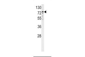 Western Blotting (WB) image for anti-Cytochrome P450, Family 2, Subfamily B, Polypeptide 6 (CYP2B6) (AA 462-488) antibody (ABIN5534097)