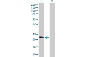 Western Blot analysis of TNFSF8 expression in transfected 293T cell line by TNFSF8 MaxPab polyclonal antibody.