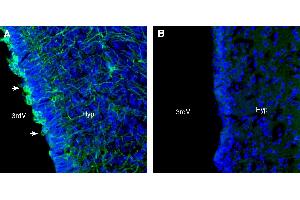 Expression of TAS1R3 in rat hypothalamusImmunohistochemical staining of perfusion-fixed frozen rat brain sections with Anti-Taste Receptor Type 1 Member 3 (TAS1R3) (extracellular) Antibody (ABIN7581990), (1:300), followed by goat anti-rabbit-AlexaFluor-488.