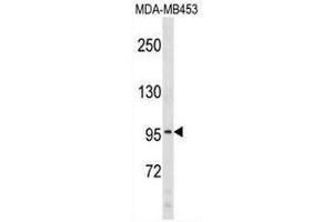 COL6A2 Antibody (C-term) western blot analysis in MDA-MB453 cell line lysates (35µg/lane).