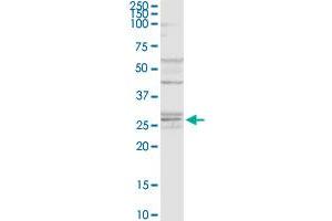 NAT6 MaxPab rabbit polyclonal antibody. (NAT6 抗体  (AA 1-308))
