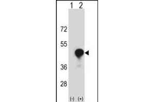Western blot analysis of CD1C (arrow) using rabbit polyclonal CD1C Antibody (C-term) (ABIN657353 and ABIN2837919). (CD1c 抗体  (C-Term))