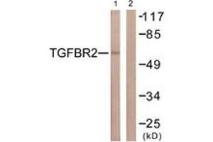 Western blot analysis of extracts from NIH-3T3 cells, using TGF beta Receptor II (Ab-250) Antibody. (TGFBR2 抗体  (AA 191-240))