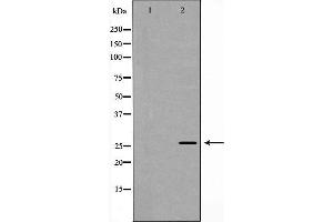 Western blot analysis of recombinant protein using Rabl2 antibody. (Rabl2 抗体)