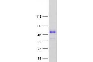 Validation with Western Blot (SCML1 Protein (Transcript Variant 3) (Myc-DYKDDDDK Tag))